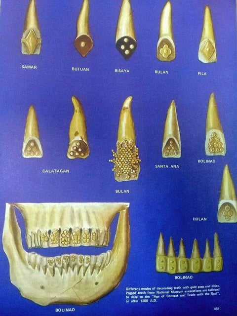 History on Philippine Jewelry: Dental Artistry in pre-Spanish Philippines